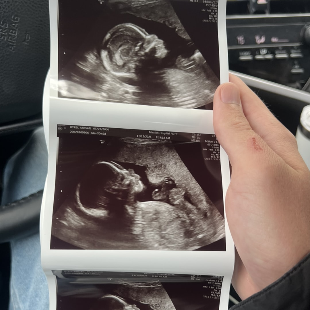 Photo shared by Abbey for their Babylist baby registry.