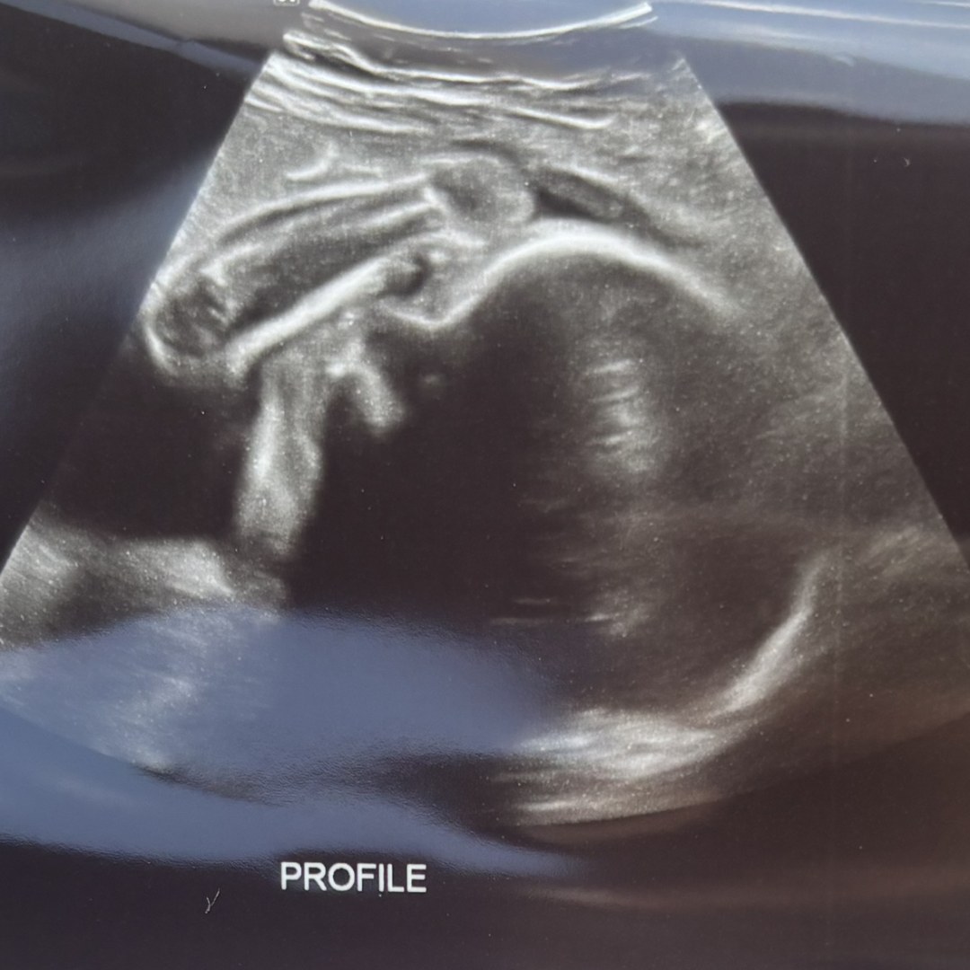 Photo shared by Jen for their Babylist baby registry.