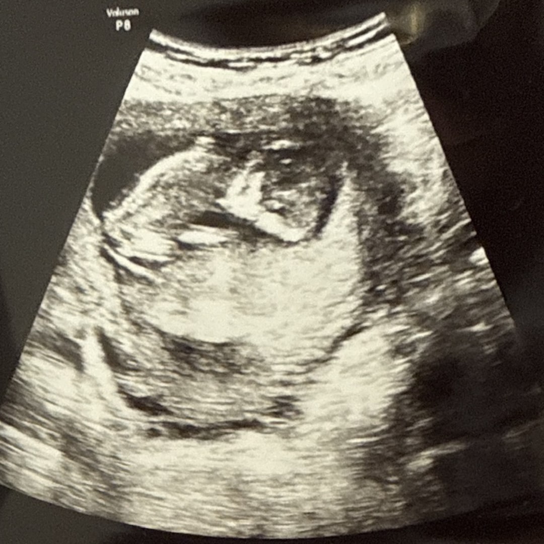 Photo shared by Iris for their Babylist baby registry.