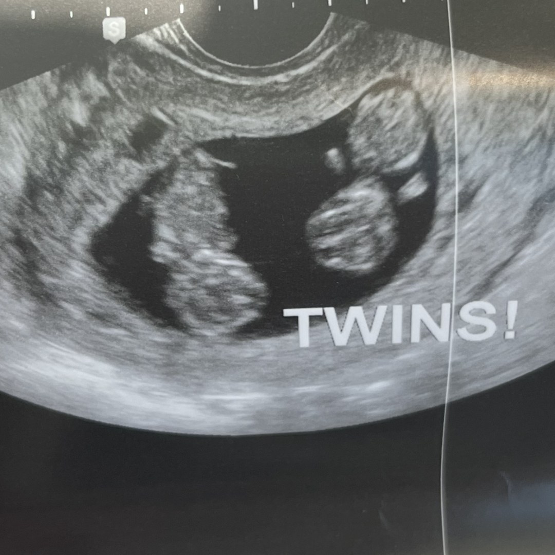 Photo shared by Cassie for their Babylist baby registry.