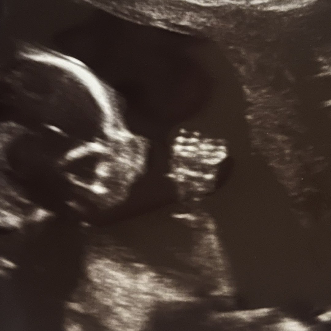 Photo shared by Kara for their Babylist baby registry.