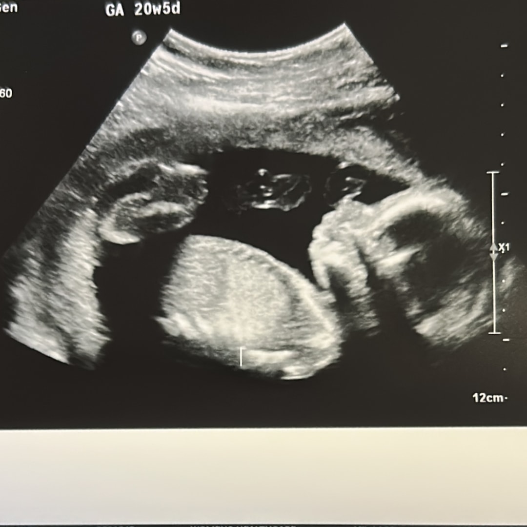 Photo shared by Vashista for their Babylist baby registry.