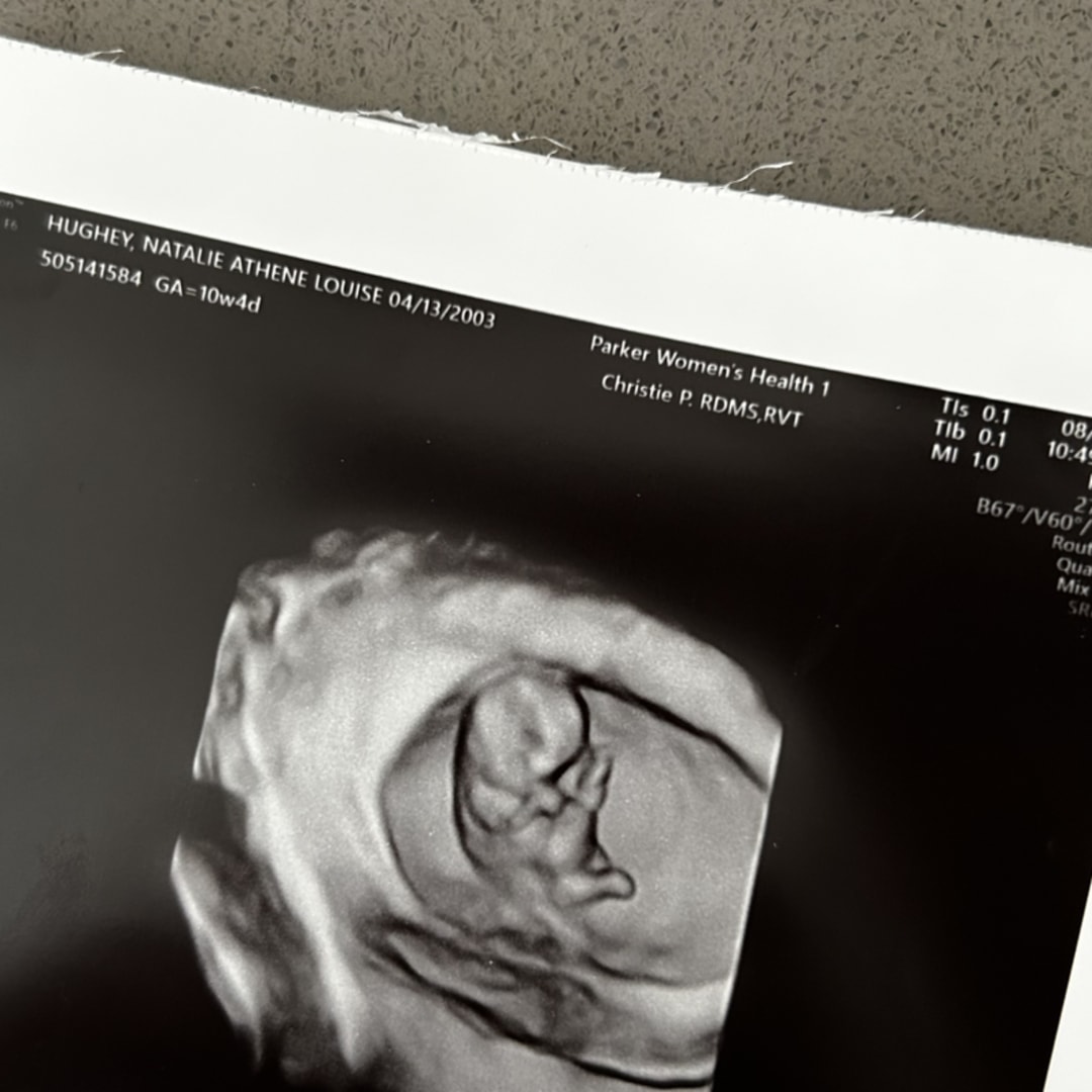 Photo shared by Natalie for their Babylist baby registry.