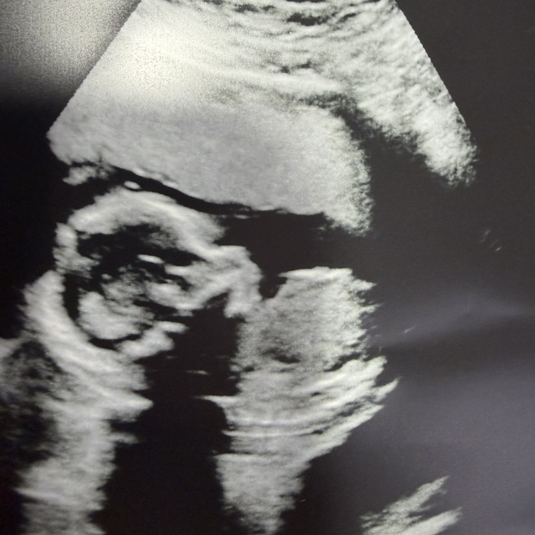 Photo shared by Courtney for their Babylist baby registry.