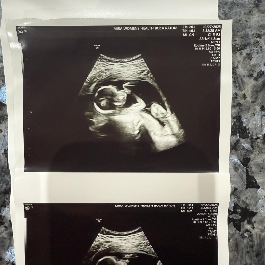 Photo shared by Lauren Louise for their Babylist baby registry.