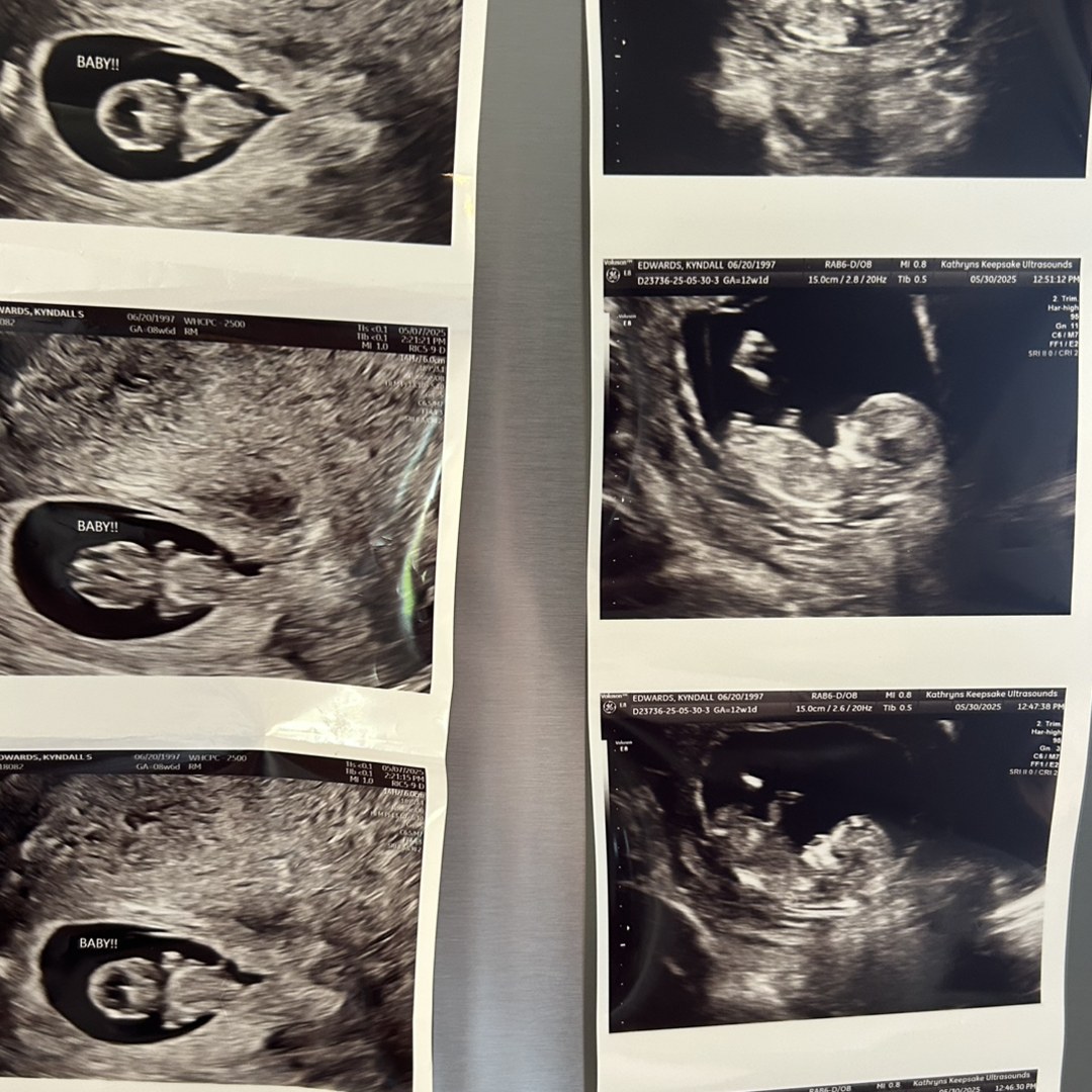 Photo shared by Kyndall for their Babylist baby registry.