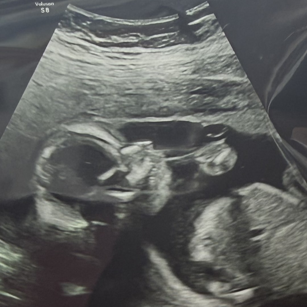 Photo shared by Carlie for their Babylist baby registry.