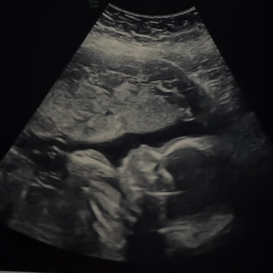 Photo shared by Jillian for their Babylist baby registry.