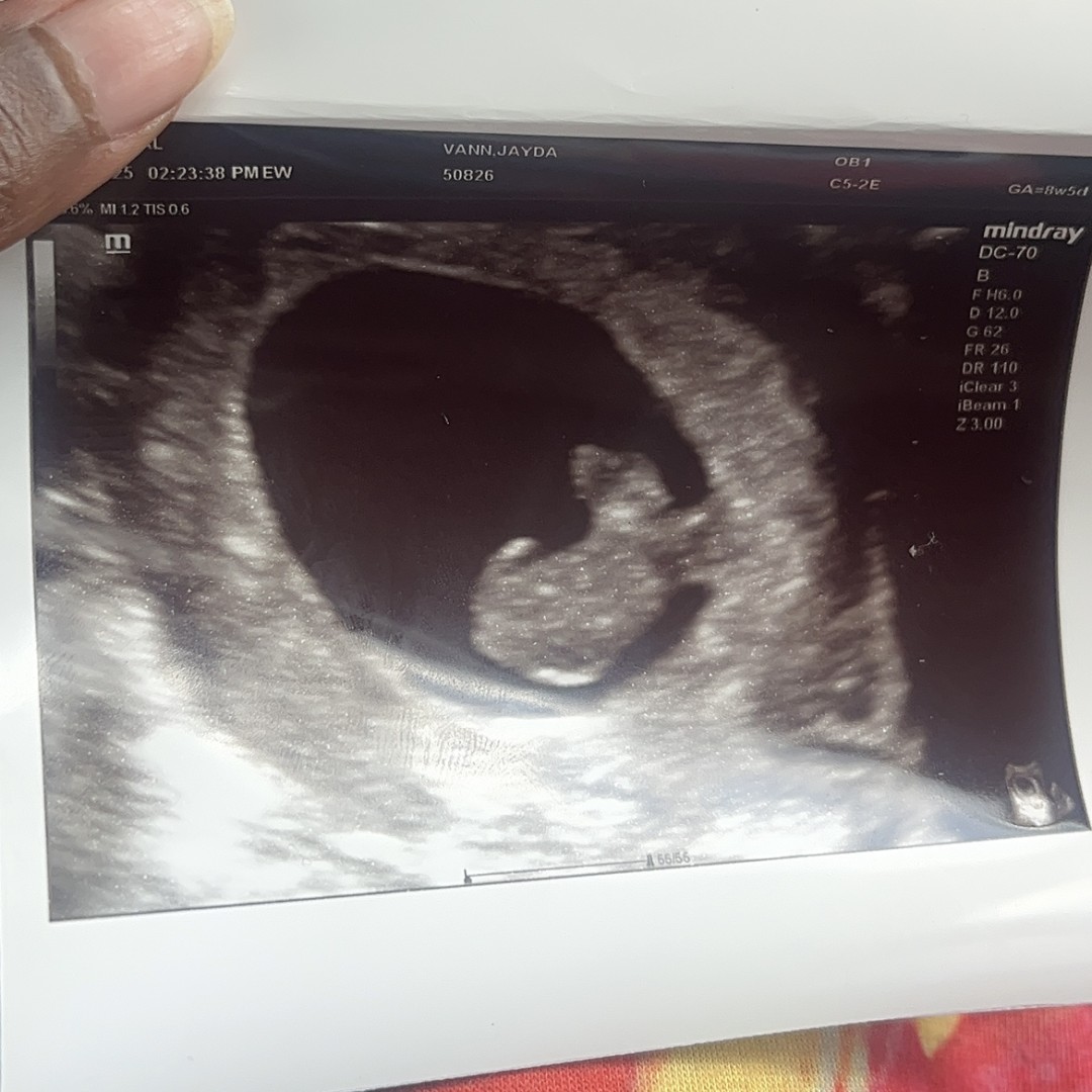 Photo shared by Jayda for their Babylist baby registry.