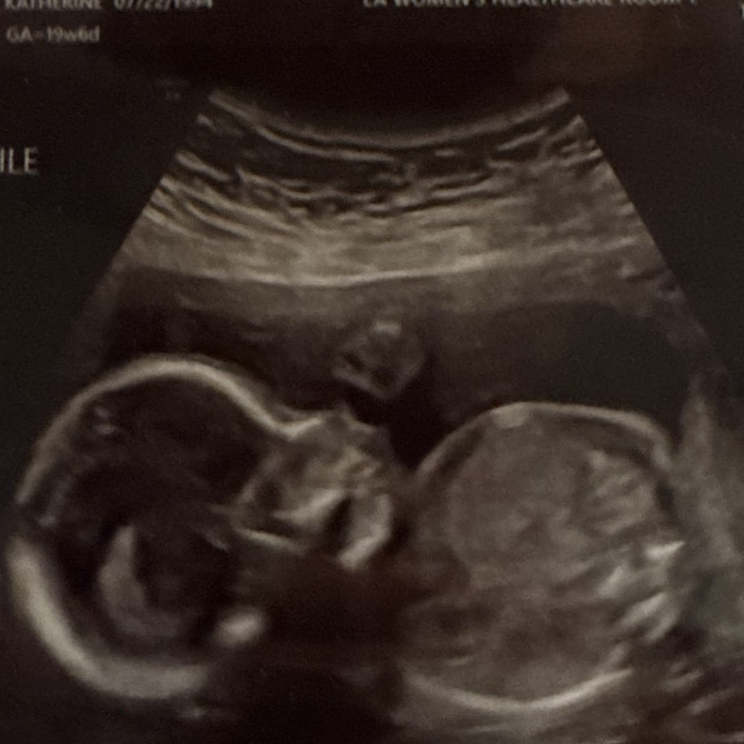 Photo shared by Katie for their Babylist baby registry.