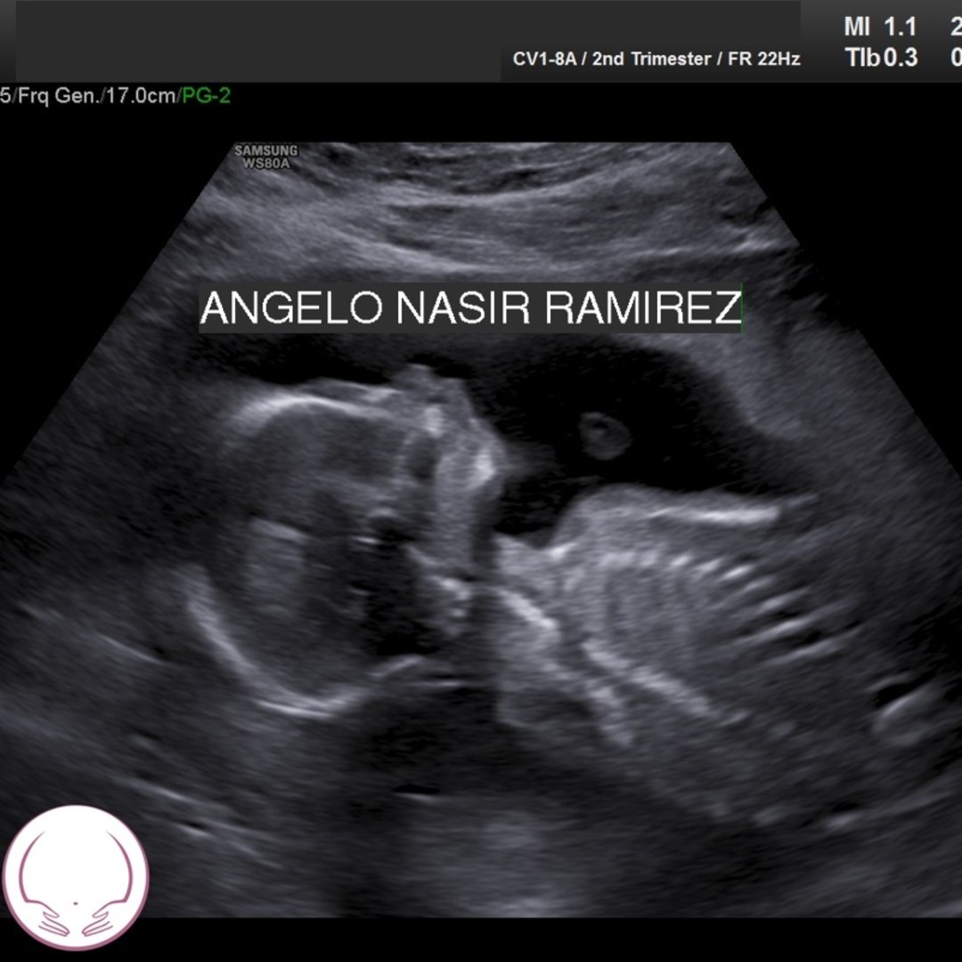 Photo shared by Neida for their Babylist baby registry.