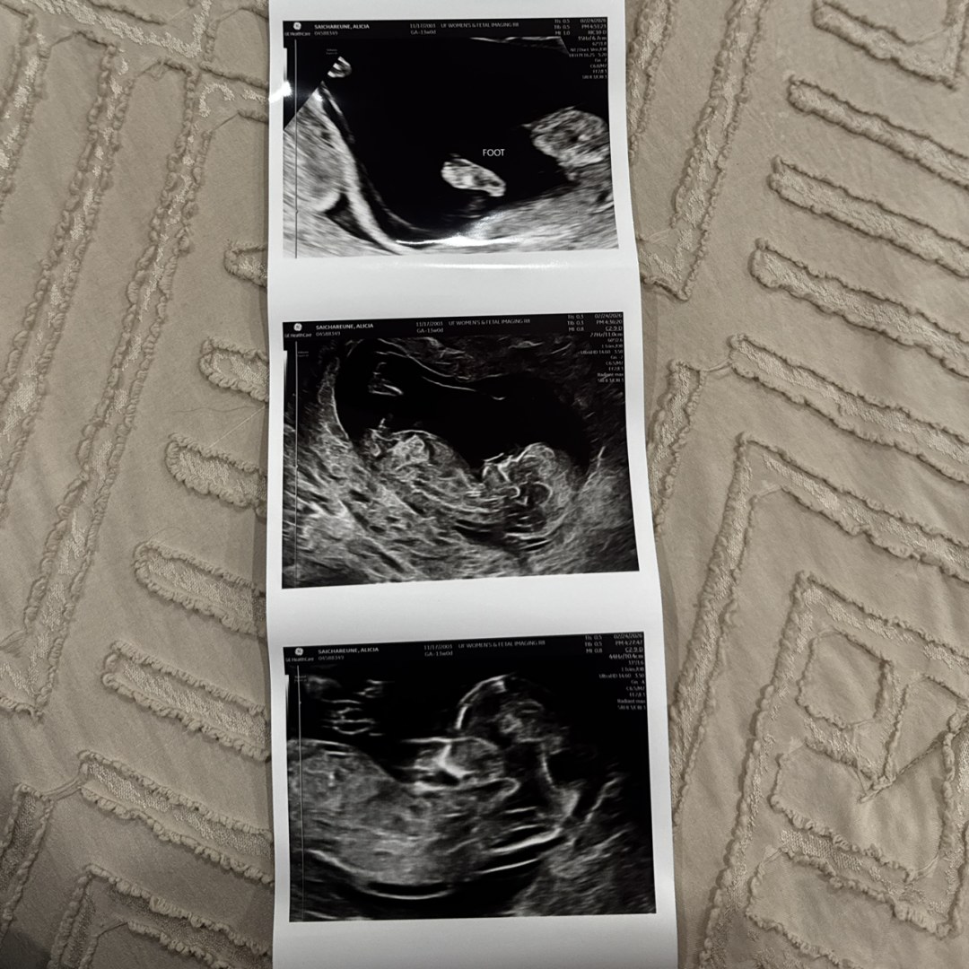 Photo shared by Alicia for their Babylist baby registry.