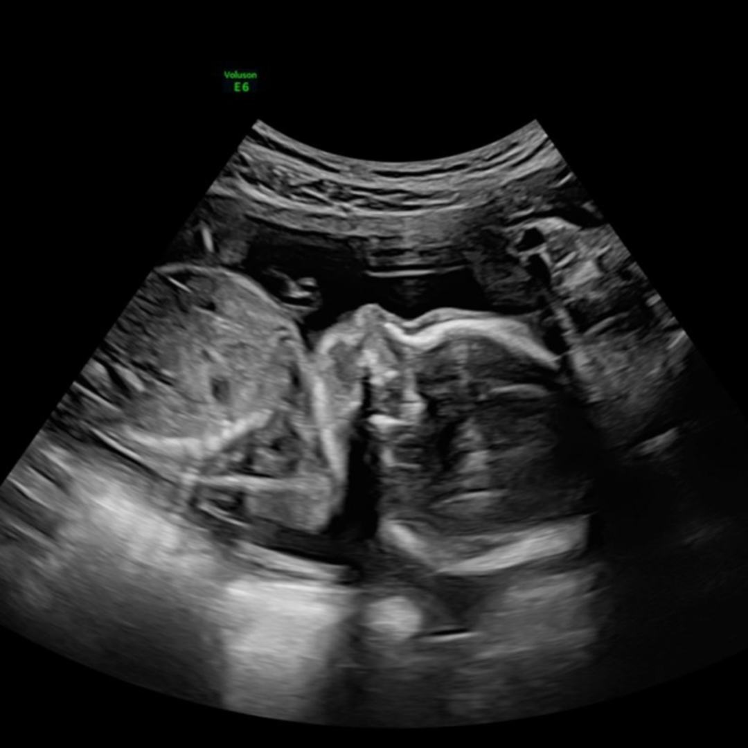 Photo shared by Katelyn for their Babylist baby registry.