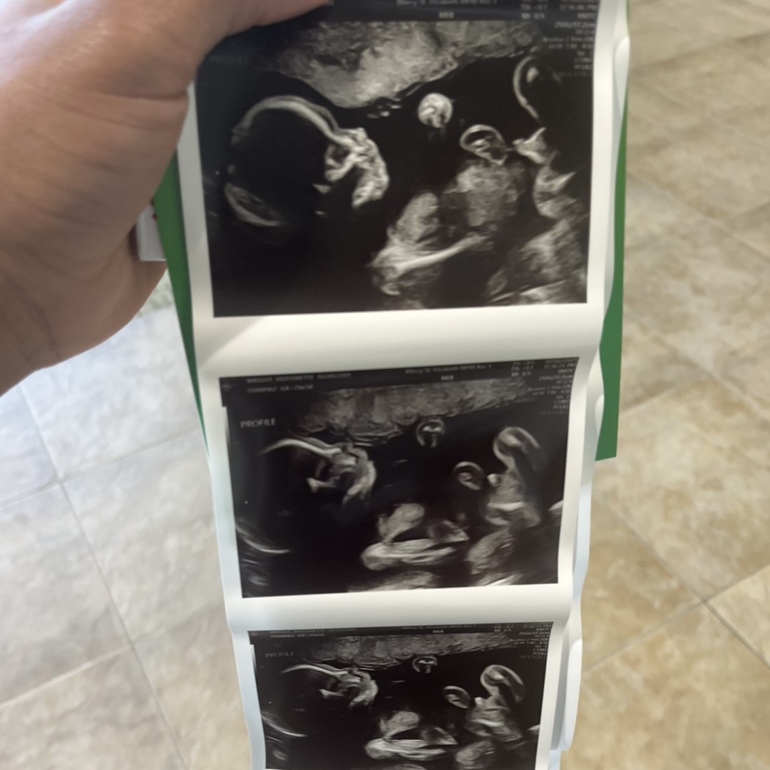 Photo shared by Antoinette for their Babylist baby registry.