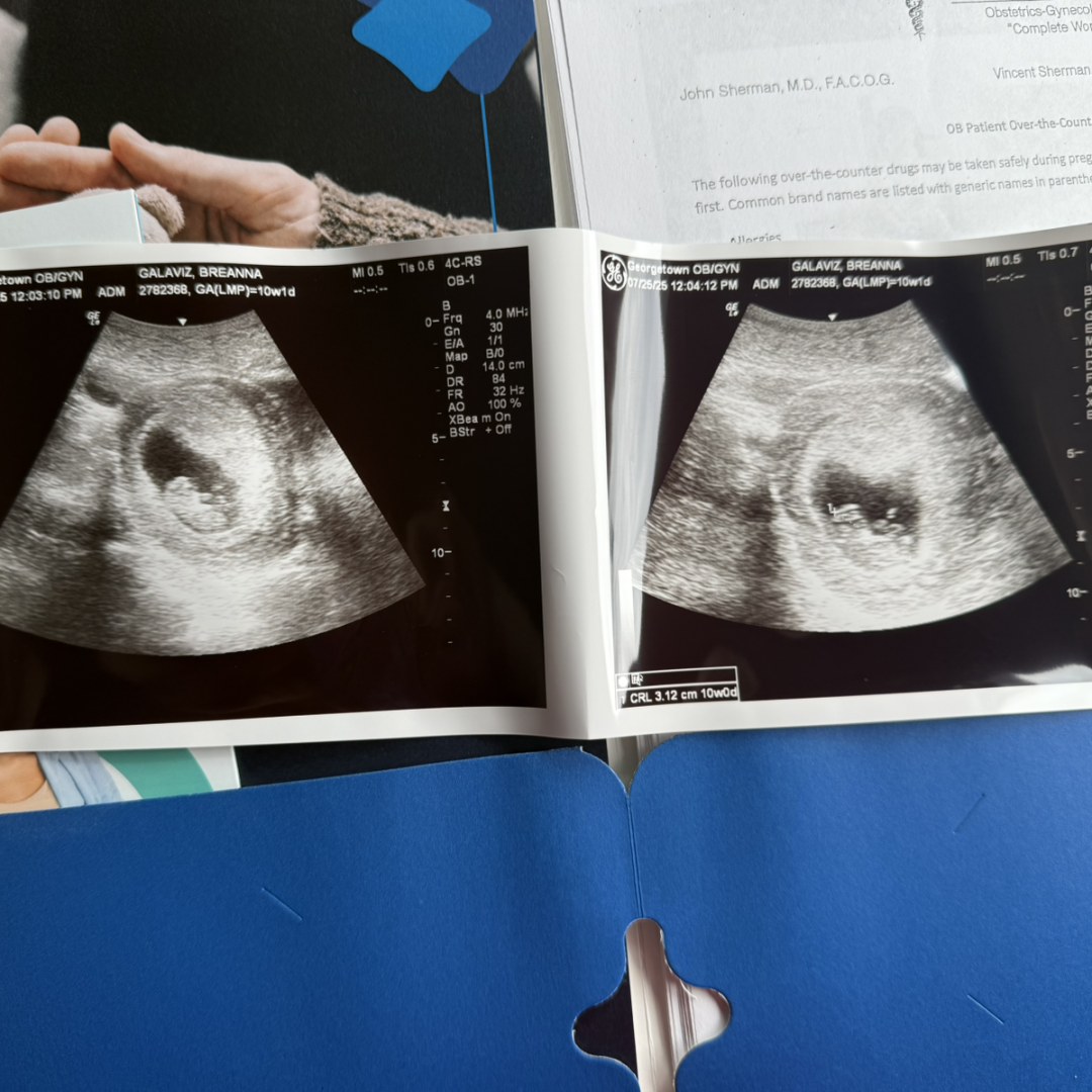 Photo shared by Breanna for their Babylist baby registry.