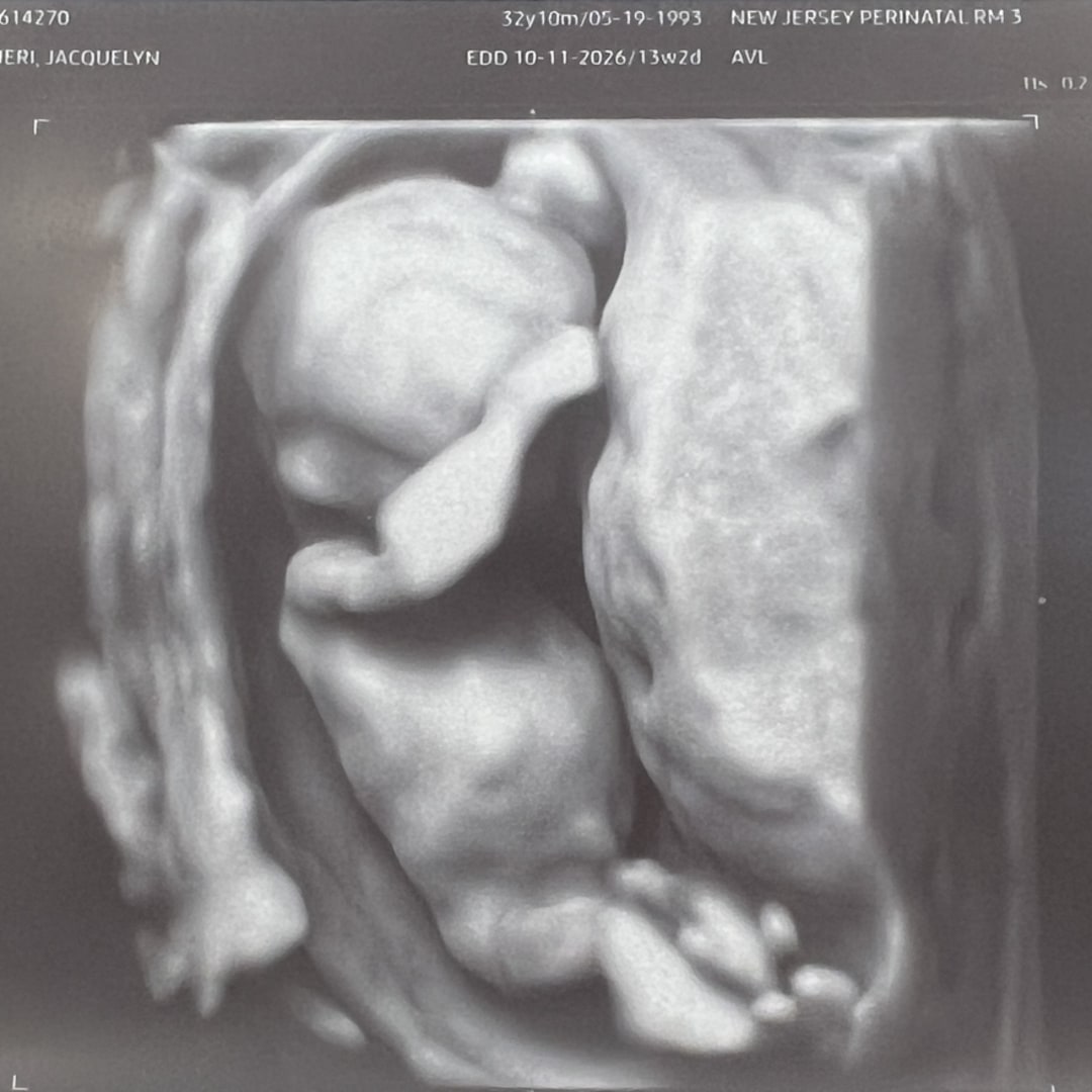 Photo shared by Jacquelyn for their Babylist baby registry.