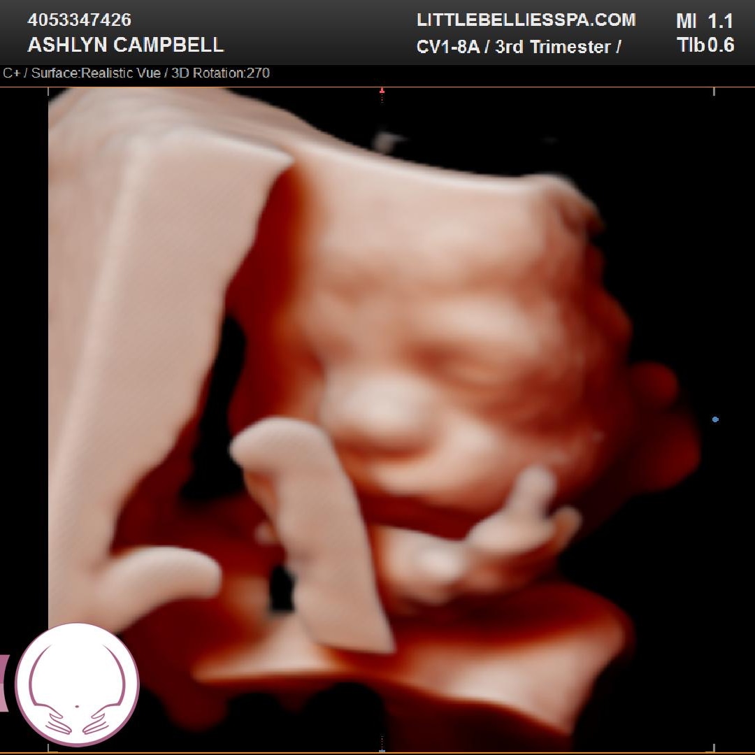 Photo shared by Ashlyn for their Babylist baby registry.