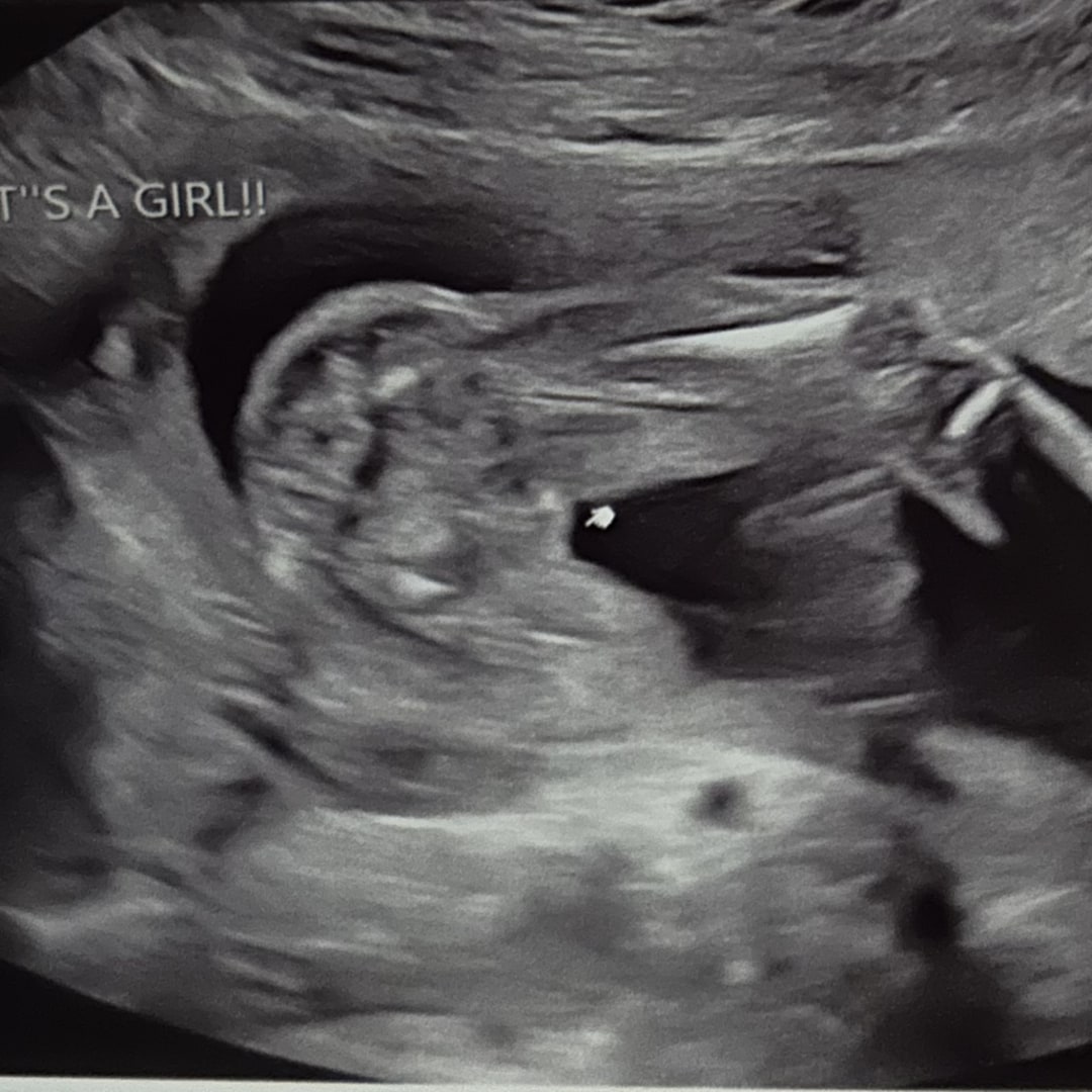 Photo shared by Felicia for their Babylist baby registry.