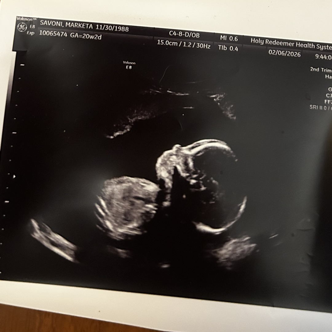 Photo shared by Marketa for their Babylist baby registry.