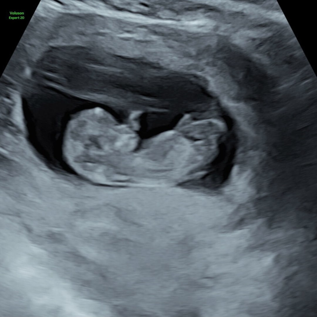 Photo shared by Tiffany for their Babylist baby registry.