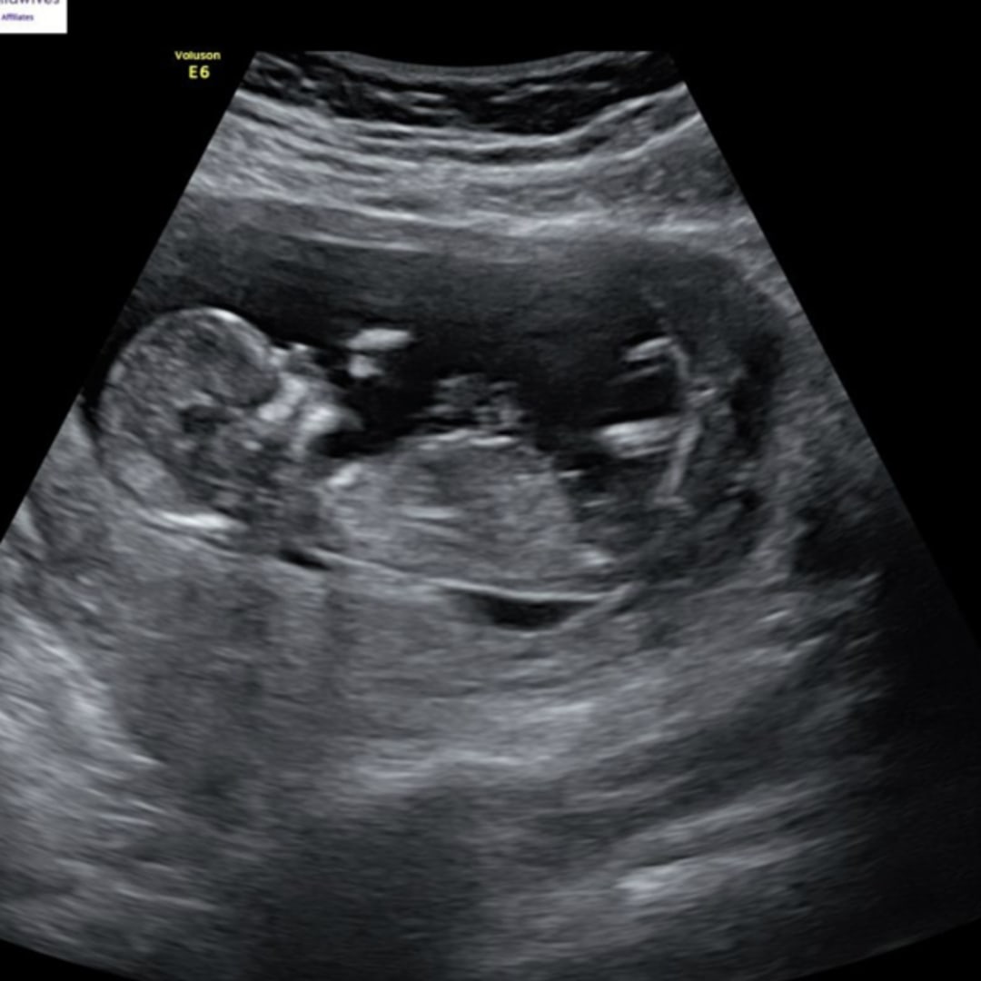 Photo shared by Bekah for their Babylist baby registry.