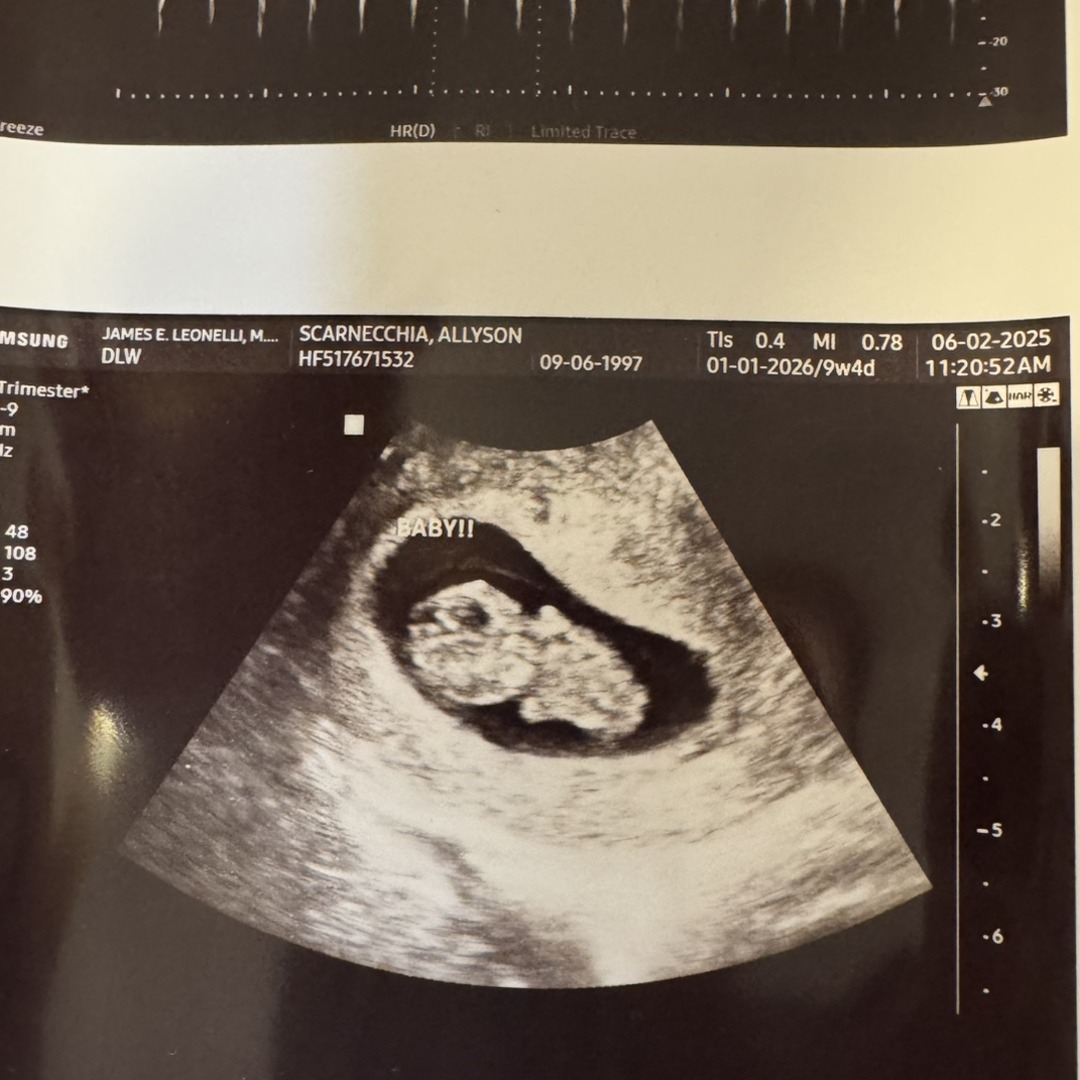 Photo shared by Allyson for their Babylist baby registry.