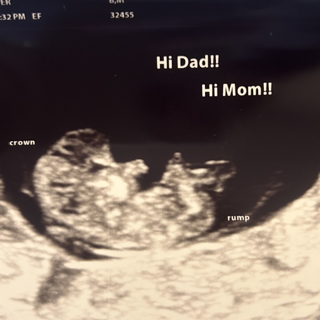 Photo shared by Mattison for their Babylist baby registry.