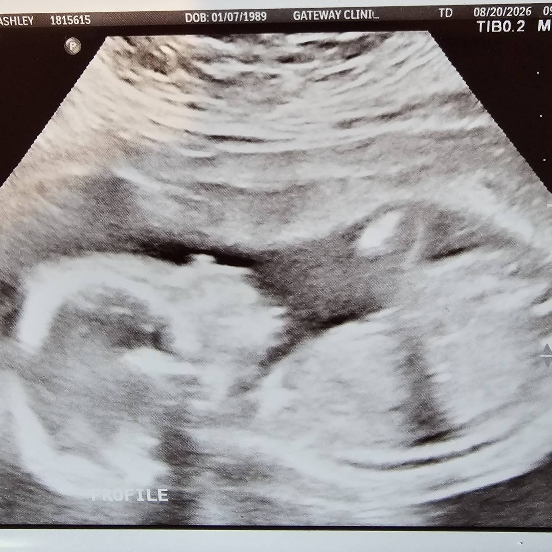 Photo shared by Ashley for their Babylist baby registry.