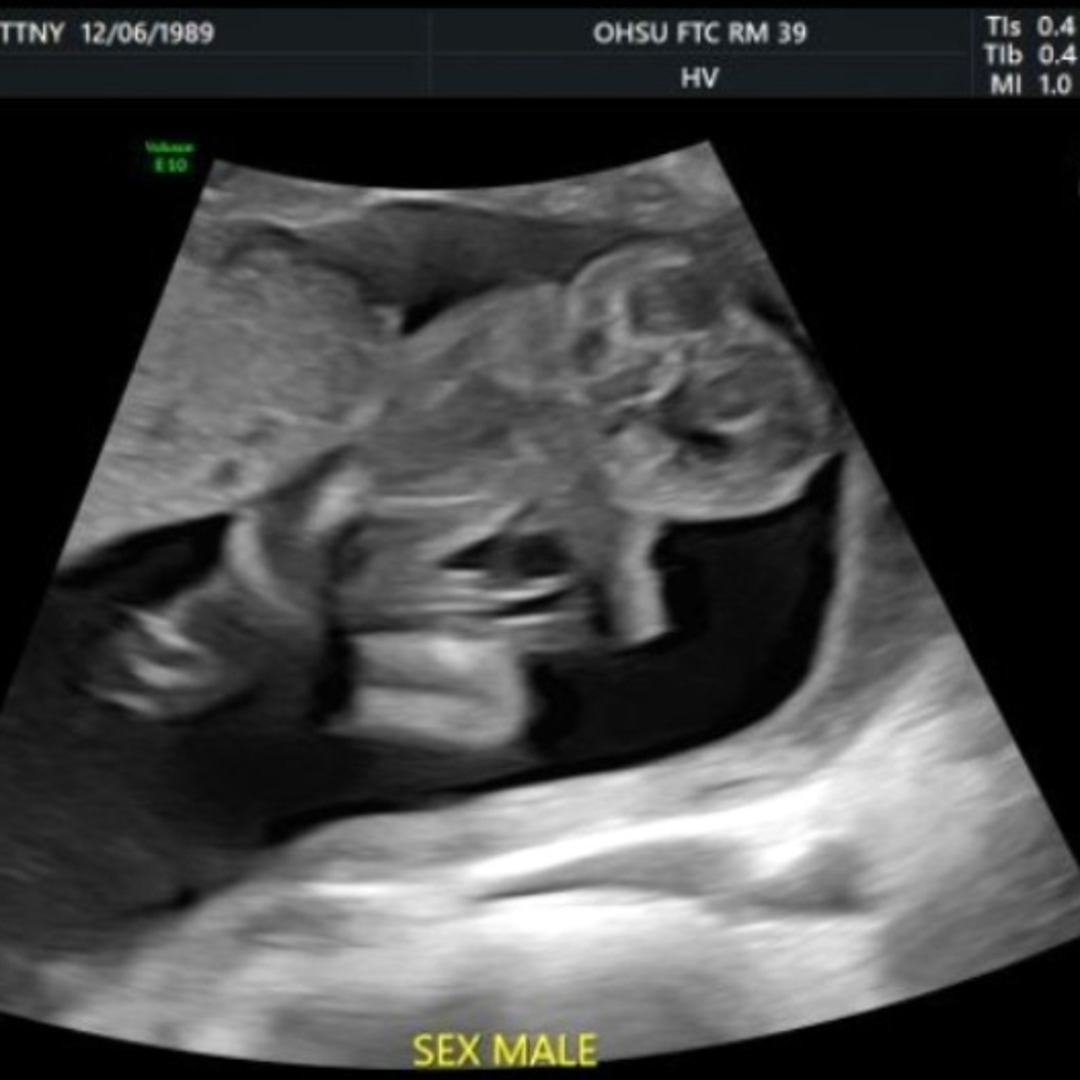 Photo shared by Brittny for their Babylist baby registry.