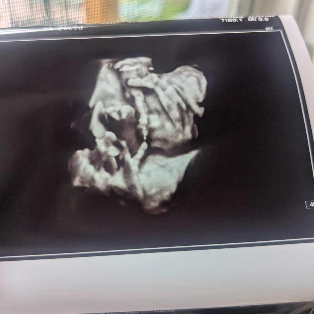 Photo shared by Hailey for their Babylist baby registry.