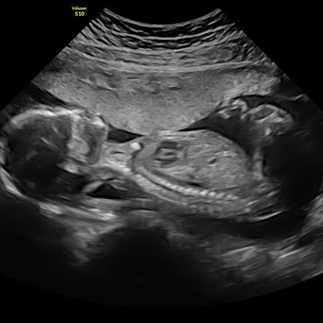 Photo shared by Alex for their Babylist baby registry.