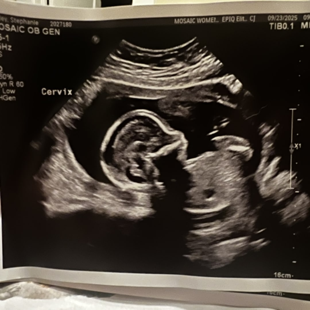 Photo shared by Stephanie for their Babylist baby registry.