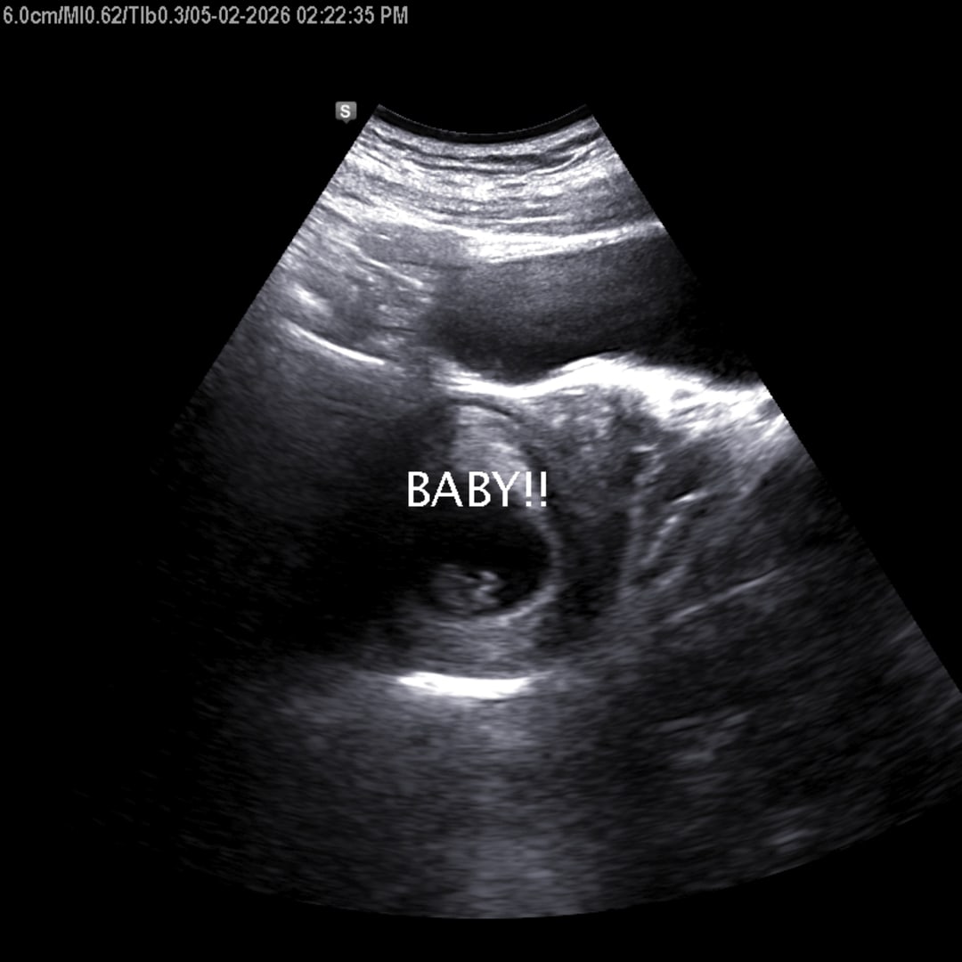 Photo shared by Alexx for their Babylist baby registry.