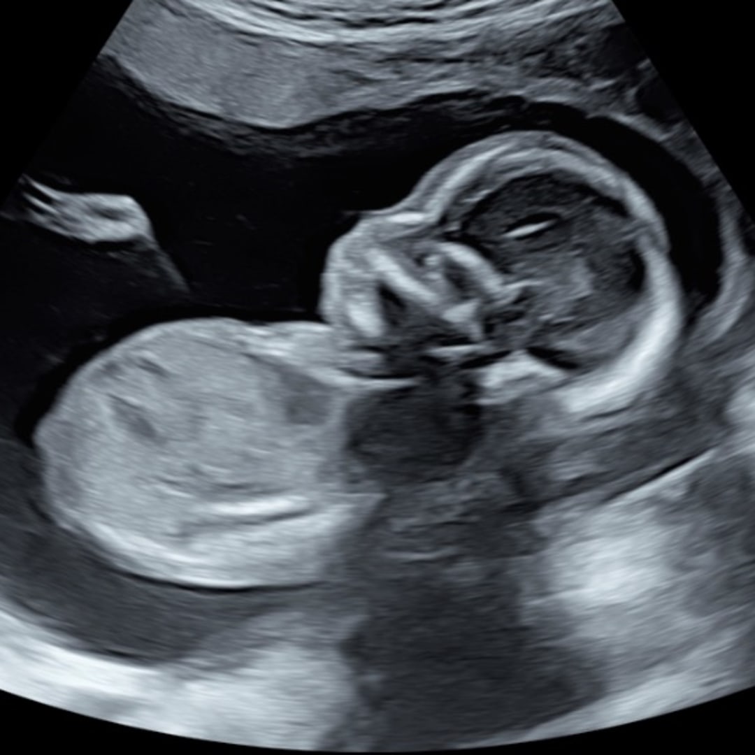 Photo shared by Brielle for their Babylist baby registry.