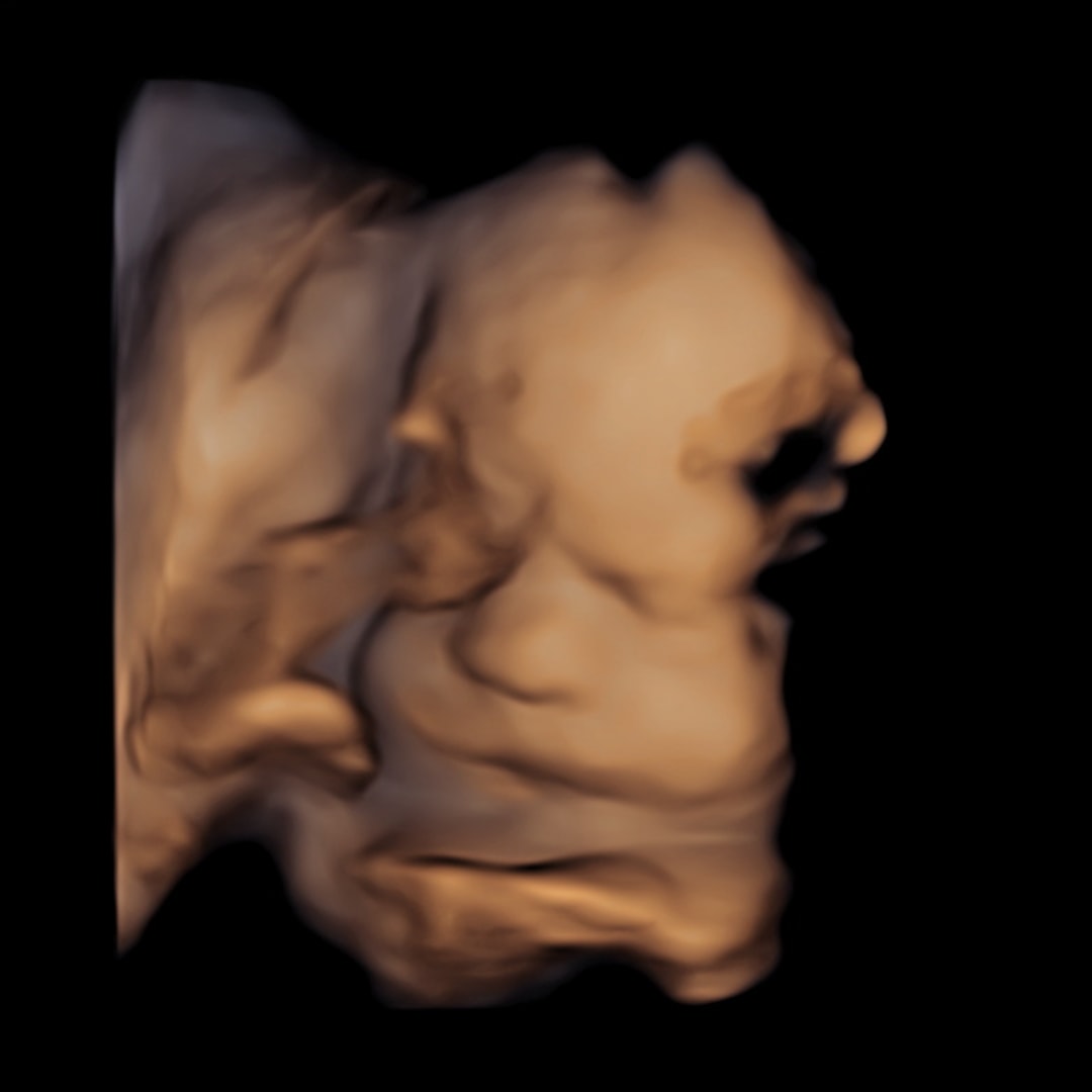 Photo shared by Victoria for their Babylist baby registry.