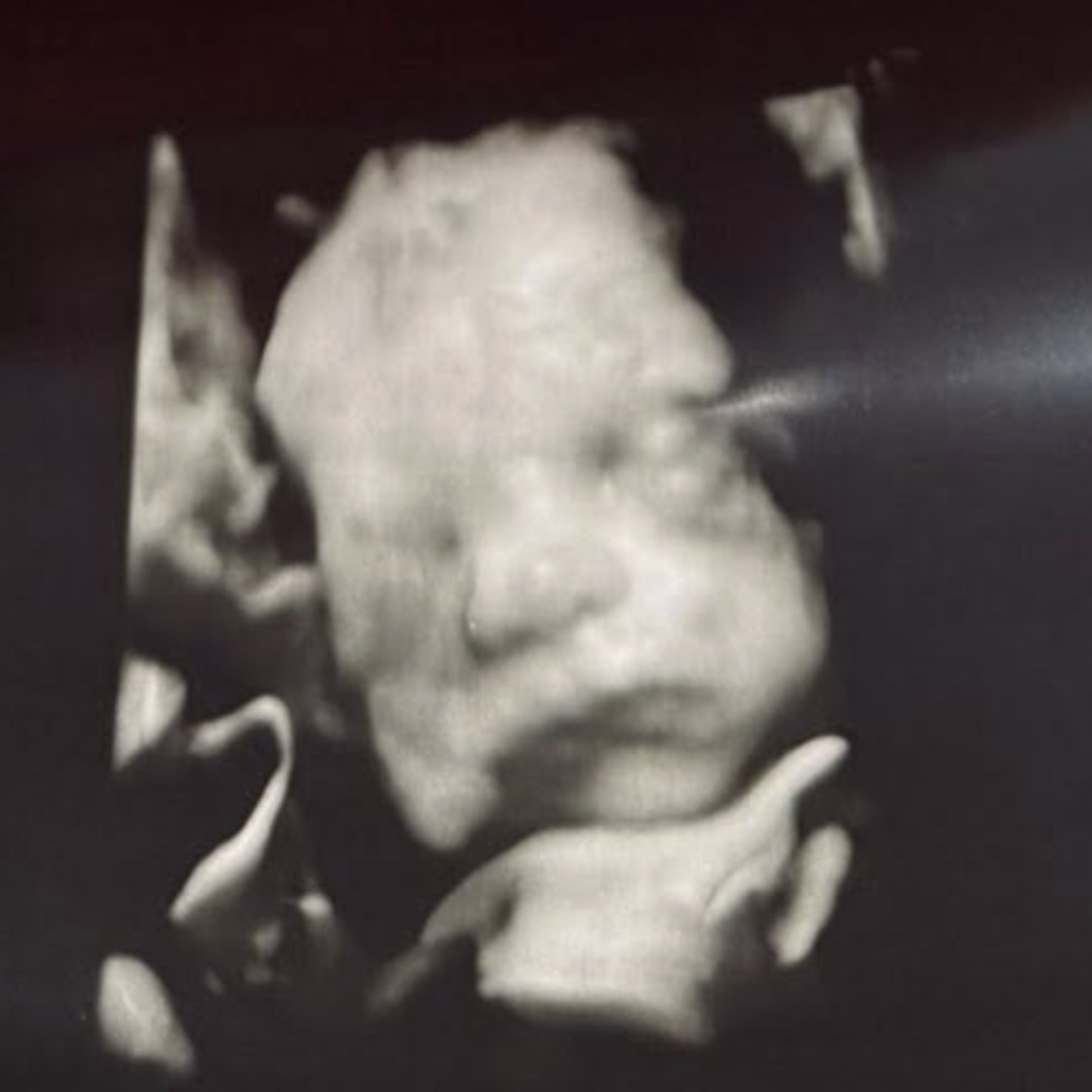 Photo shared by Emma for their Babylist baby registry.