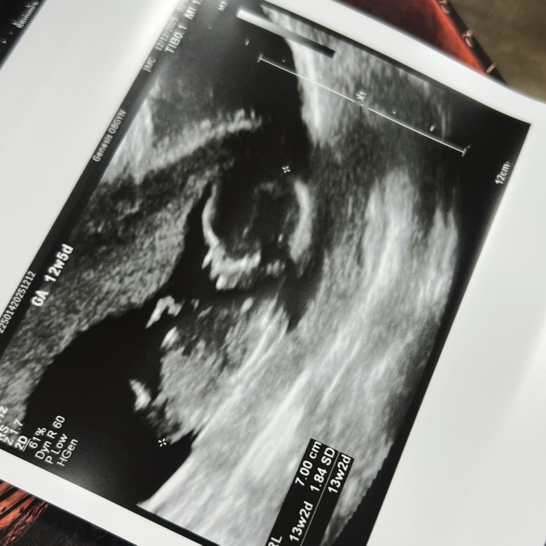 Photo shared by Zachary for their Babylist baby registry.