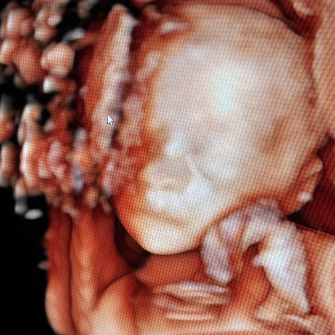 Photo shared by Vanessa for their Babylist baby registry.