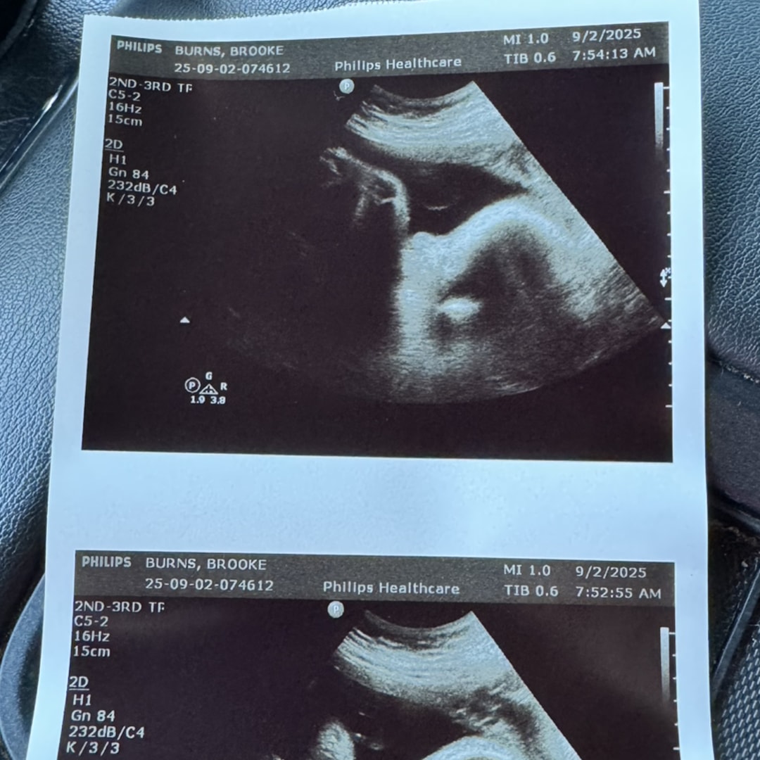 Photo shared by Brooke for their Babylist baby registry.