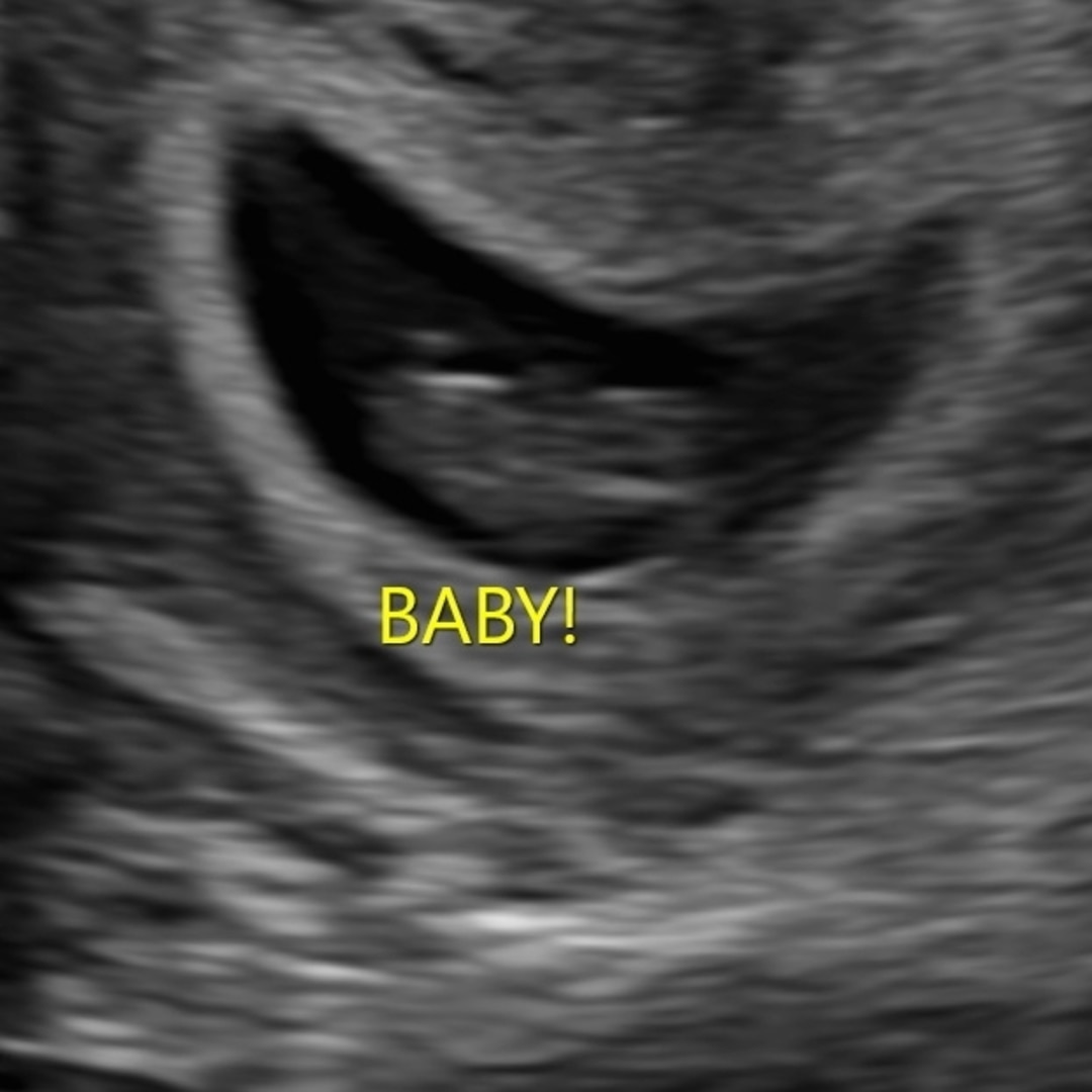 Photo shared by Erik for their Babylist baby registry.