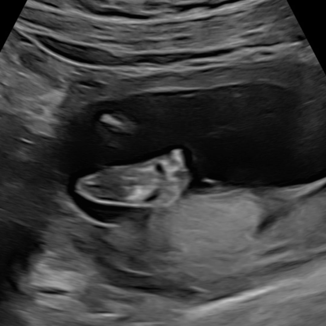 Photo shared by Ana for their Babylist baby registry.