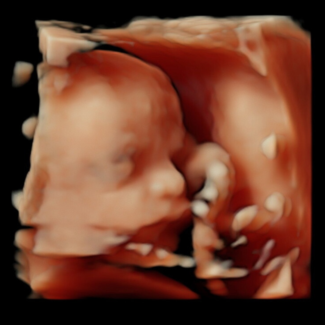 Photo shared by Jaimee for their Babylist baby registry.