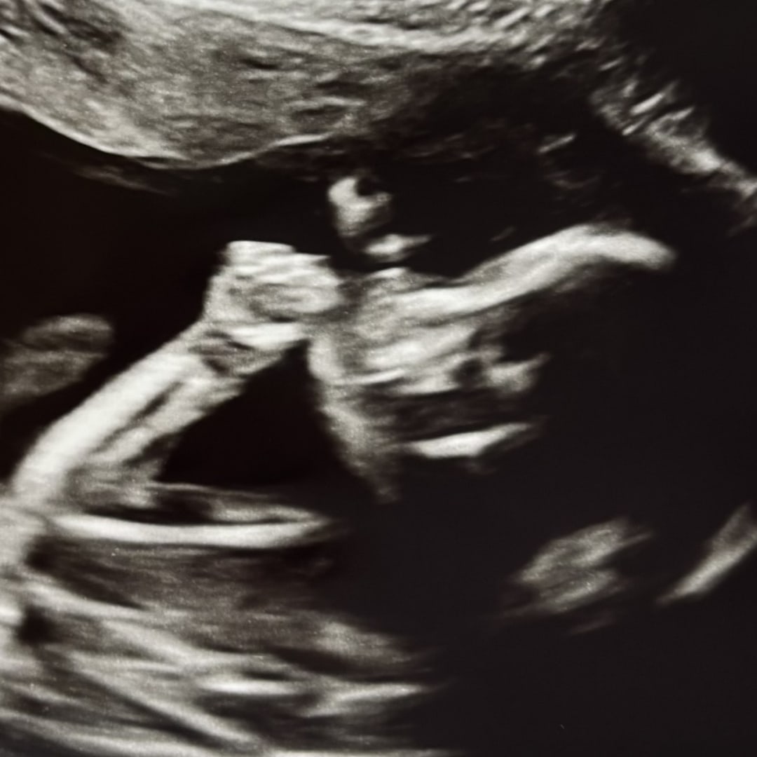Photo shared by Autumn for their Babylist baby registry.