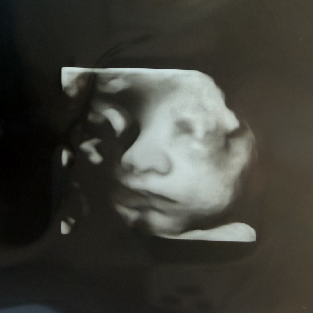 Photo shared by Megan for their Babylist baby registry.