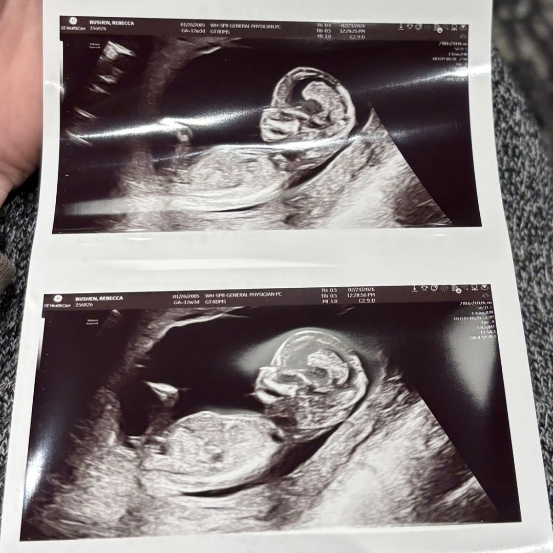 Photo shared by Rebecca for their Babylist baby registry.