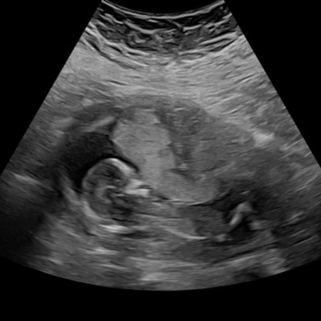 Photo shared by Chalee for their Babylist baby registry.