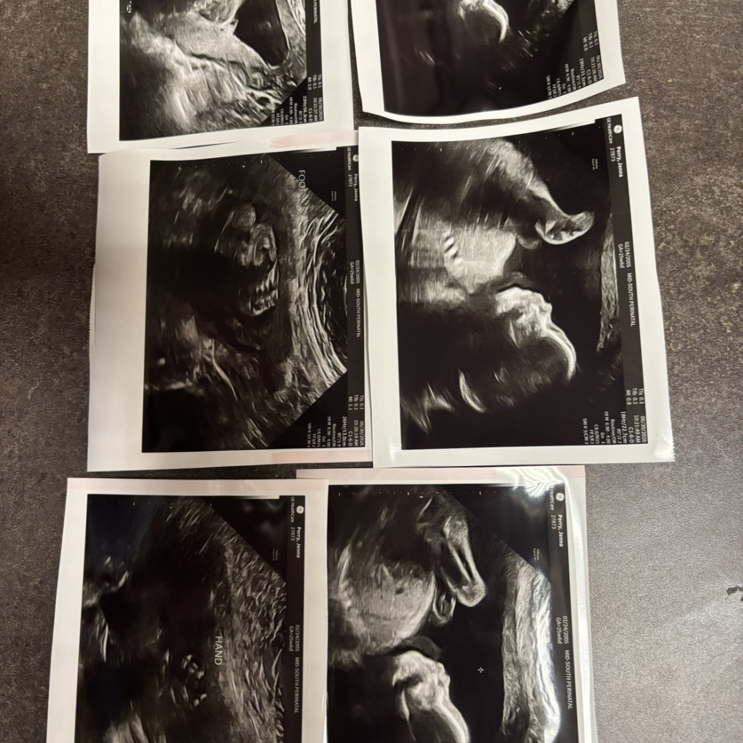 Photo shared by Jenna for their Babylist baby registry.
