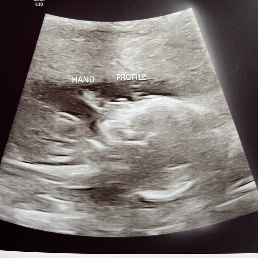 Photo shared by Melissa for their Babylist baby registry.