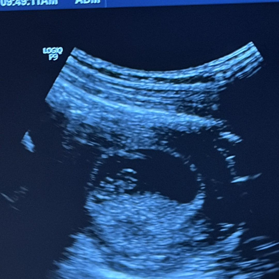 Photo shared by Ashley for their Babylist baby registry.