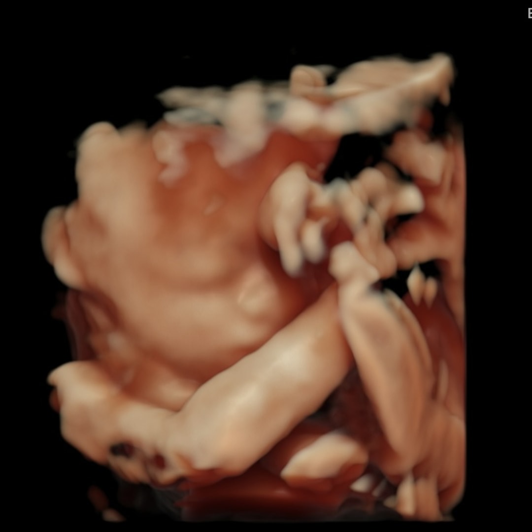 Photo shared by Emily for their Babylist baby registry.